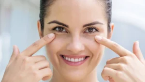 Giải Pháp Cải Thiện Bọng Mắt Không Phẫu Thuật