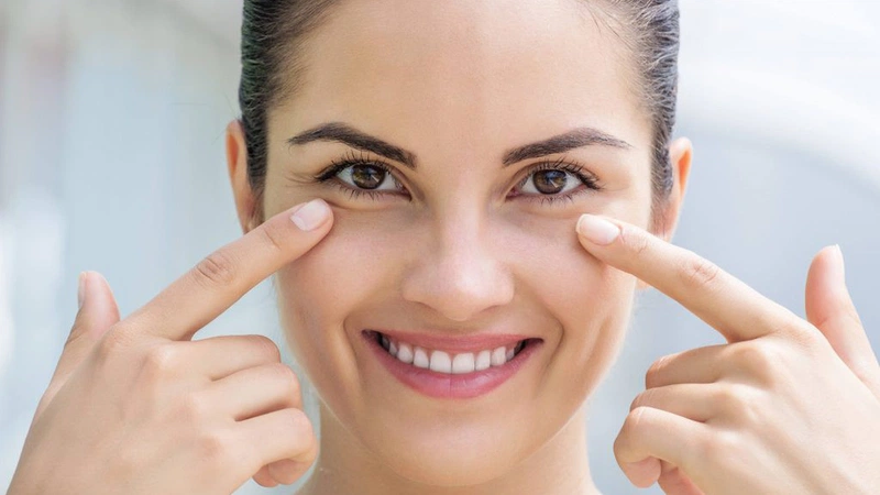 Giải Pháp Cải Thiện Bọng Mắt Không Phẫu Thuật